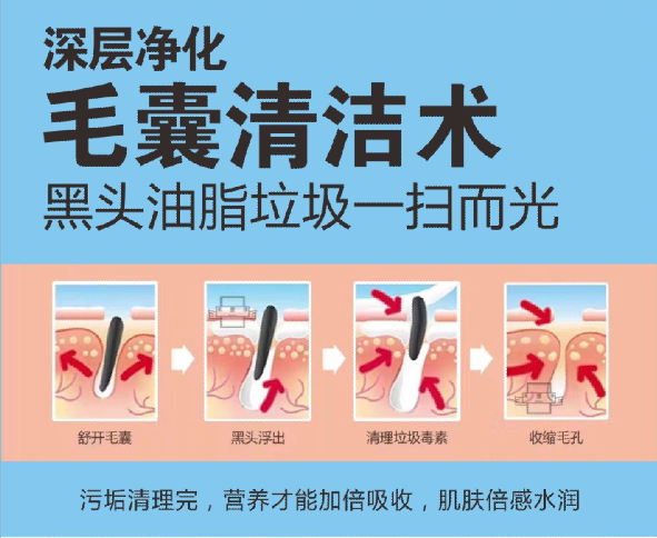 厲害了，我用【毛囊清潔術】促成了一段姻緣...